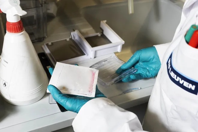 Detecting proteins